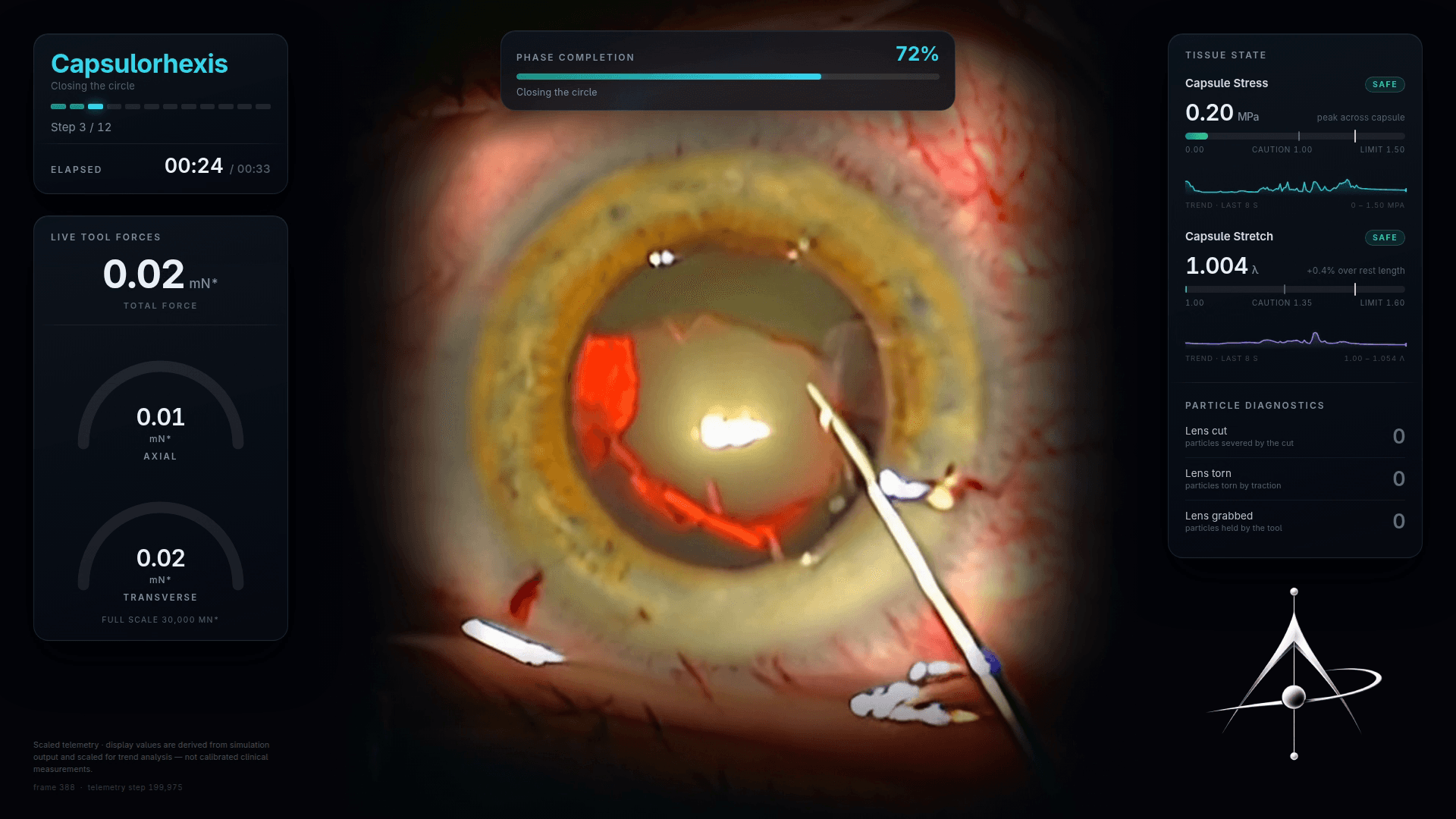 A capsulorhexis in progress, step 3 of 12, with live tool forces in millinewtons, capsule stress and stretch against their caution and limit thresholds, and particle diagnostics for the cut.